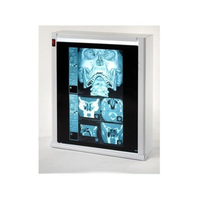 Διαφανοσκόπιο μονό