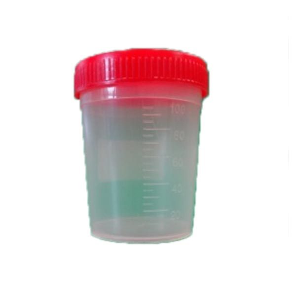 Ποτηράκια καλλιέργειας ούρων